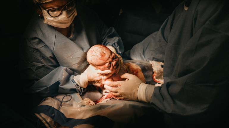 surgeon delivering baby during c-section
