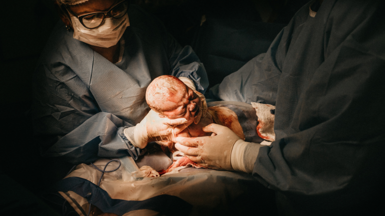 12 C-Section Recovery Tips To Heal Fast  C section recovery, C section,  Baby hacks